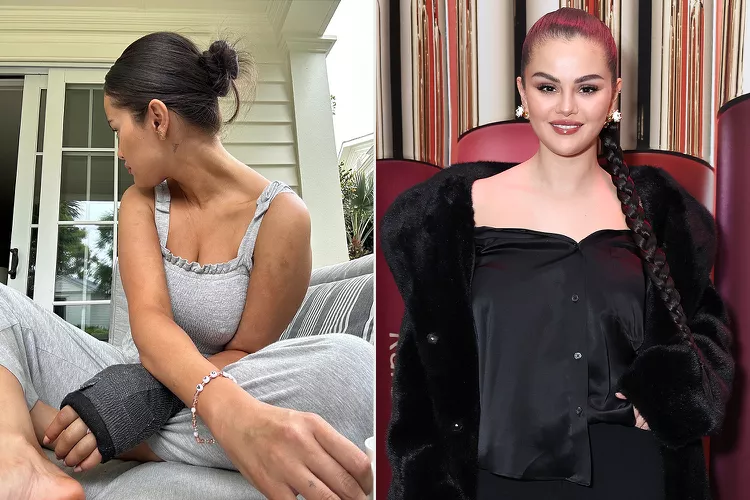 Selena Gomez Unveils New Images of Casted Arm Following a Mishap in a Summer Outfit
Selena Gomez's recent selfie showcases her injured arm.
